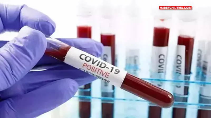 ABD’de her hafta 300’den fazla kişi COVID-19 nedeniyle hayatını kaybediyor