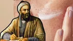 Bin yıllık reçete! İbn-i Sina’dan güneş lekelerine doğal formül