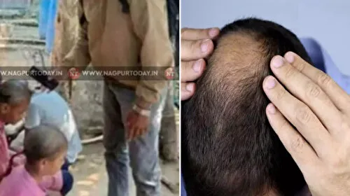 Kellik Virüsü Alarmı! Hindistan'da Yüzlerce Kişi Saçlarını Kaybetti