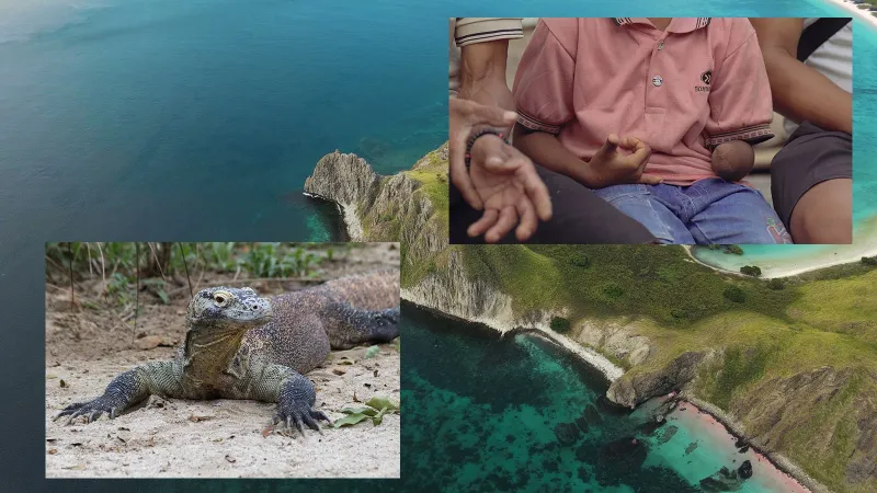 Komodo Ejderi Dehşeti! Kolunu Kaybeden Çocuğa Türk Ekip Şefkati