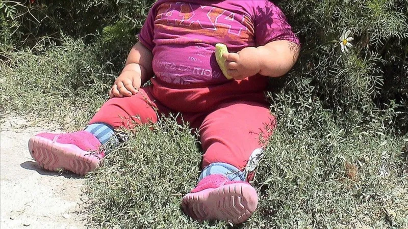 Uzmanı uyardı: Her 10 çocuktan 1'i obez!